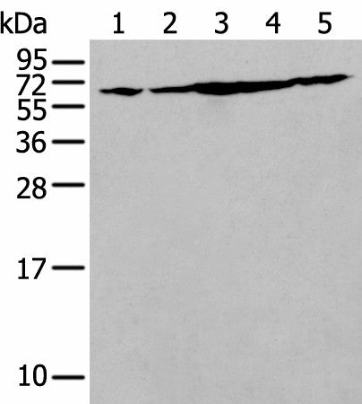 Western blot analysis of NIH/3T3 Hela Jurkat Hepg2 and A549 cell lysates using IRF5 Polyclonal Antibody at dilution of 1:250