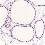 Anti-Human/Rat/Mouse PAX8 Antibody [A323]