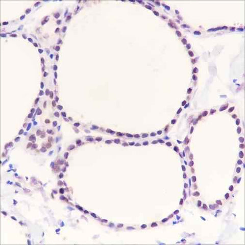 Anti-Human/Rat/Mouse PAX8 Antibody [A323] - ABMIUM