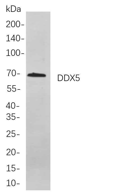 Anti-Human/Mouse/Rat DDX5 Antibody [B856] - ABMIUM