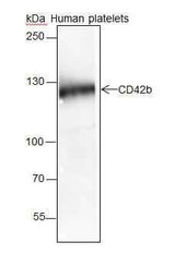 Anti-Human/Rat/Mouse CD42b Antibody [A174]