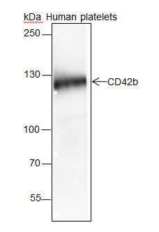 Anti-Human/Rat/Mouse CD42b Antibody [A174] - ABMIUM
