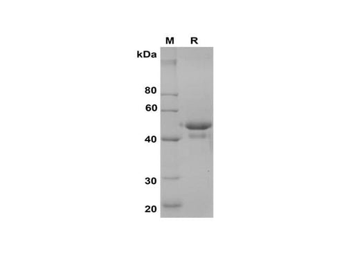 SDS-PAGE analysis of Mouse Carbonic Anhydrase 9/CA9 proteins, 2 μg/lane of Recombinant Mouse Carbonic Anhydrase 9/CA9 proteins was resolved with SDS-PAGE under reducing conditions, showing bands at 50 kDa.