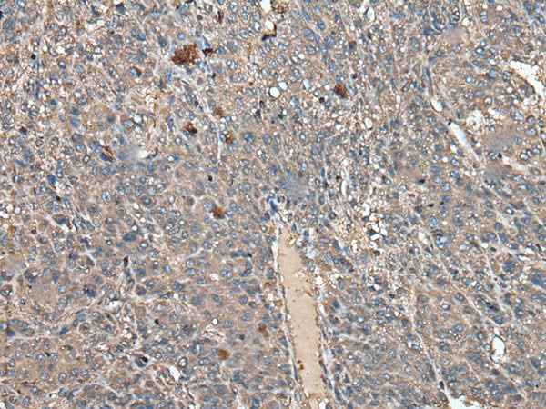 Anti-Human/Mouse/Rat ATAD1 Antibody