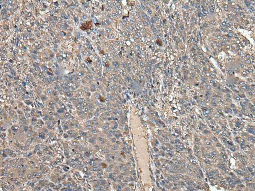 Anti-Human/Mouse/Rat ATAD1 Antibody