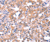 Anti-Human FAT1 Antibody - ABMIUM