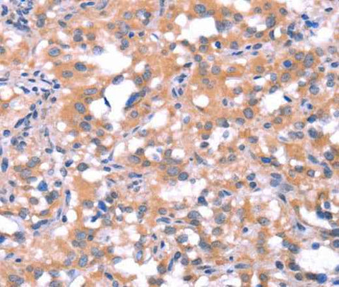 Anti-Human FAT1 Antibody