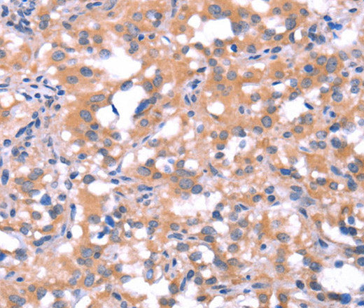 Anti-Human FAT1 Antibody - ABMIUM
