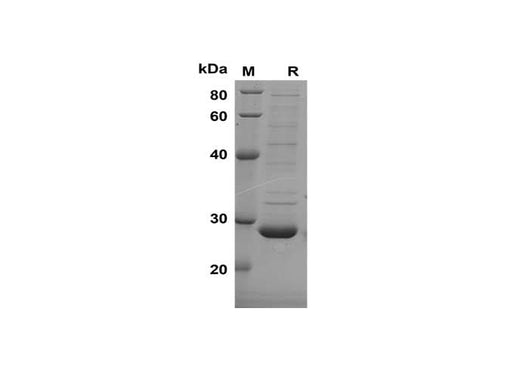 SDS-PAGE analysis of Rat PRL proteins, 2 μg/lane of Recombinant Rat PRL proteins was resolved with SDS-PAGE under reducing conditions, showing bands at 28 kDa.