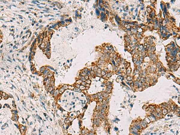 Anti-Human/Mouse/Rat PDHA1 Antibody