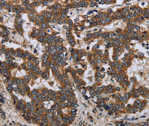 Anti-Human/Mouse LGALS2 Antibody