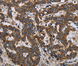 Anti-Human/Mouse LGALS2 Antibody - ABMIUM
