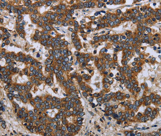 Anti-Human/Mouse LGALS2 Antibody - ABMIUM