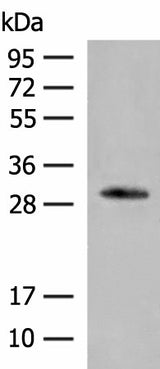 Western blot analysis of Human left thymus tissue lysate using VDAC3 Polyclonal Antibody at dilution of 1:200
