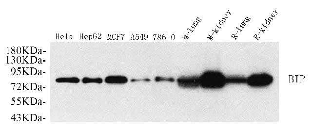 Western Blot analysis of various samples using HSPA5 Polyclonal Antibody at dilution of 1:1000.