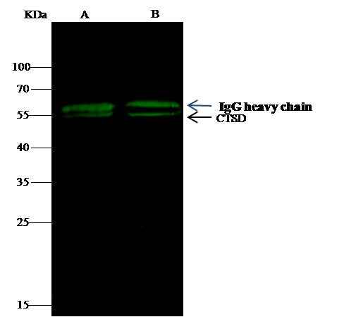 Anti-Mouse CTSD Antibody [B409] - ABMIUM