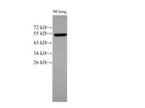 Anti-Human/Mouse CK-7 Antibody - ABMIUM