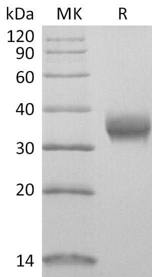 Recombinant SARS-CoV-2 Spike RBD (N354D)(His Tag) - ABMIUM