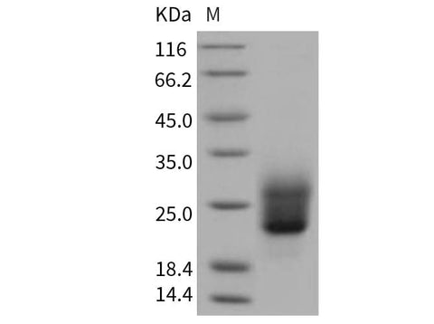 SDS-PAGE analysis of Human NKp30/NCR3 proteins, 2 μg/lane of Recombinant Human NKp30/NCR3 proteins was resolved with SDS-PAGE under reducing conditions, showing bands at 25 kDa.