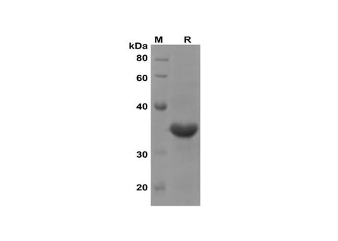 SDS-PAGE analysis of Rat TNF-α proteins, 2 μg/lane of Recombinant Rat TNF-α proteins was resolved with SDS-PAGE under reducing conditions, showing bands at 35 kDa.