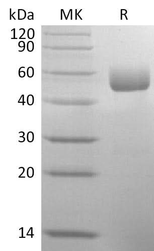 Recombinant Mouse SerpinA1/A1AT Protein (His Tag) - ABMIUM