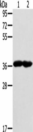 Anti-Human/Mouse/Rat GNAT3 Antibody - ABMIUM