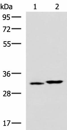 Western blot analysis of 293T cell lysates using CBR3 Polyclonal Antibody at dilution of 1:800