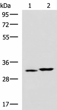 Western blot analysis of 293T cell lysates using CBR3 Polyclonal Antibody at dilution of 1:800