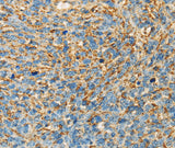 Anti-Human APOA4 Antibody - ABMIUM