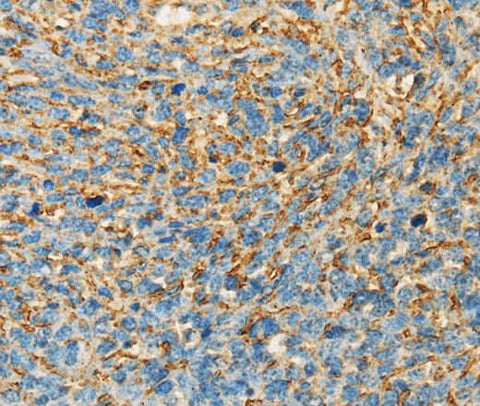Anti-Human APOA4 Antibody - ABMIUM
