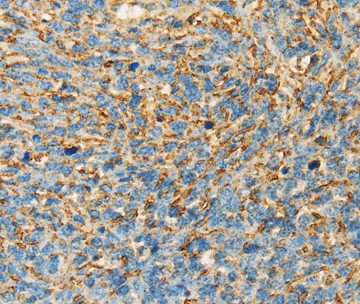 Anti-Human APOA4 Antibody - ABMIUM