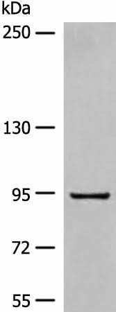 Anti-Human DMGDH Antibody - ABMIUM