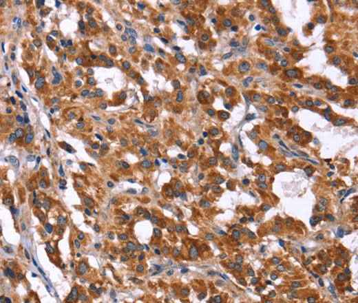 Anti-Human/Mouse/Rat HACE1 Antibody