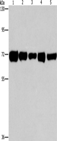 Anti-Human/Mouse/Rat RPN1 Antibody - ABMIUM