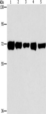 Anti-Human/Mouse/Rat RPN1 Antibody - ABMIUM