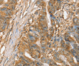 Anti-Human/Mouse SLC41A2 Antibody - ABMIUM