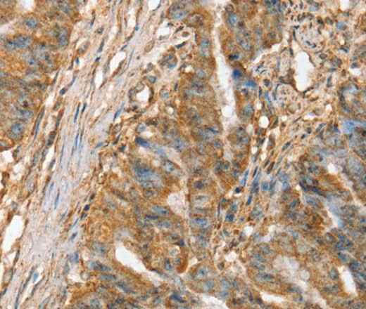 Anti-Human/Mouse SLC41A2 Antibody