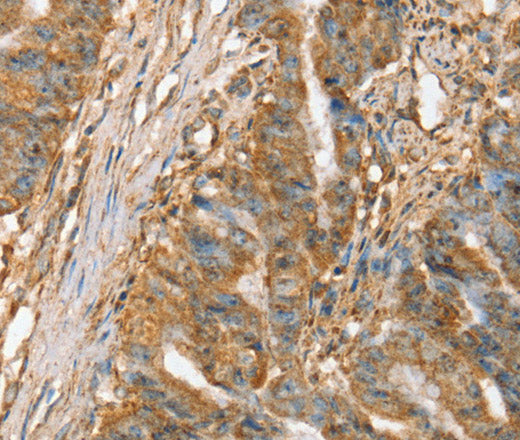 Anti-Human/Mouse SLC41A2 Antibody - ABMIUM
