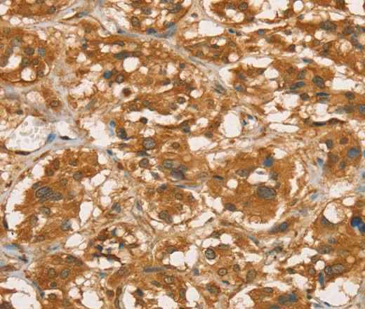 Anti-Human/Mouse/Rat RBBP8 Antibody