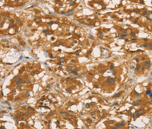 Anti-Human/Mouse/Rat RBBP8 Antibody - ABMIUM