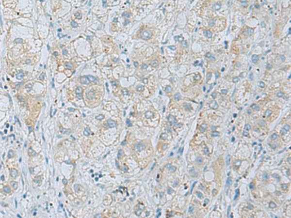 Anti-Human/Mouse/Rat NAGK Antibody