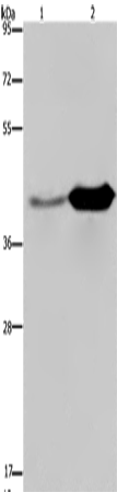 Anti-Human/Mouse/Rat GLUL Antibody - ABMIUM