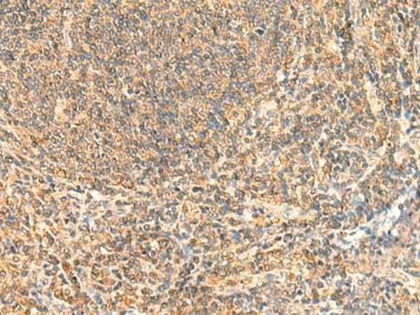 Anti-Human ZNF581 Antibody