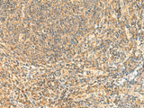 Immunohistochemistry of paraffin-embedded Human tonsil tissue using ZNF581 Polyclonal Antibody at dilution of 1:50(×200)