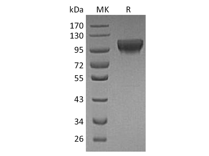 Recombinant Human HER4/ErbB4 Protein (His Tag) - ABMIUM