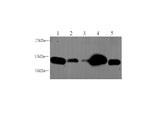 Anti-Human/Mouse/Rat IFITM3 Antibody - ABMIUM