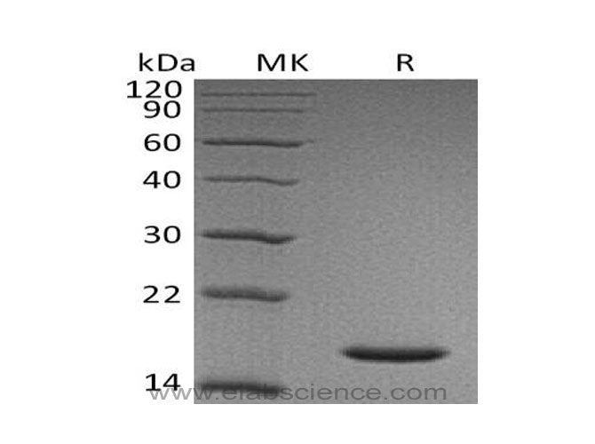Recombinant Human Cystatin SN/CST1 Protein (His Tag) - ABMIUM