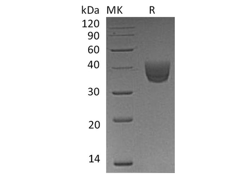Recombinant Human CD157/BST1 Protein (His Tag) - ABMIUM