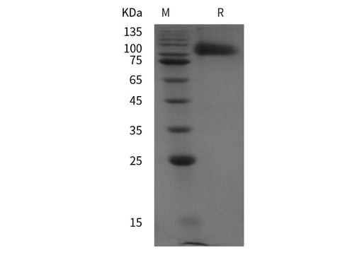 SDS-PAGE analysis of Rat ICAM-1/CD54 proteins, 2 μg/lane of Recombinant Rat ICAM-1/CD54 proteins was resolved with SDS-PAGE under reducing conditions, showing bands at 90 kDa.
