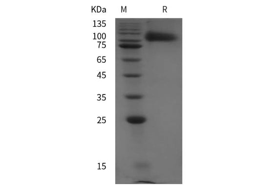 SDS-PAGE analysis of Rat ICAM-1/CD54 proteins, 2 μg/lane of Recombinant Rat ICAM-1/CD54 proteins was resolved with SDS-PAGE under reducing conditions, showing bands at 90 kDa.